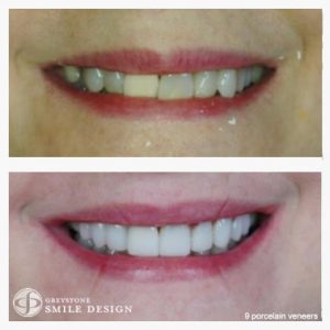 cosmetic-dentist-patient-case-photo-11